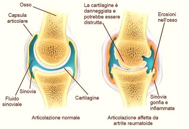 problemi artrite cane
