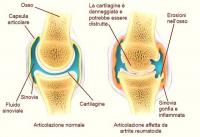problemi artrite cane