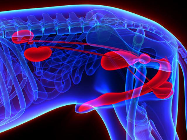 agoaspirato adenoma prostatico